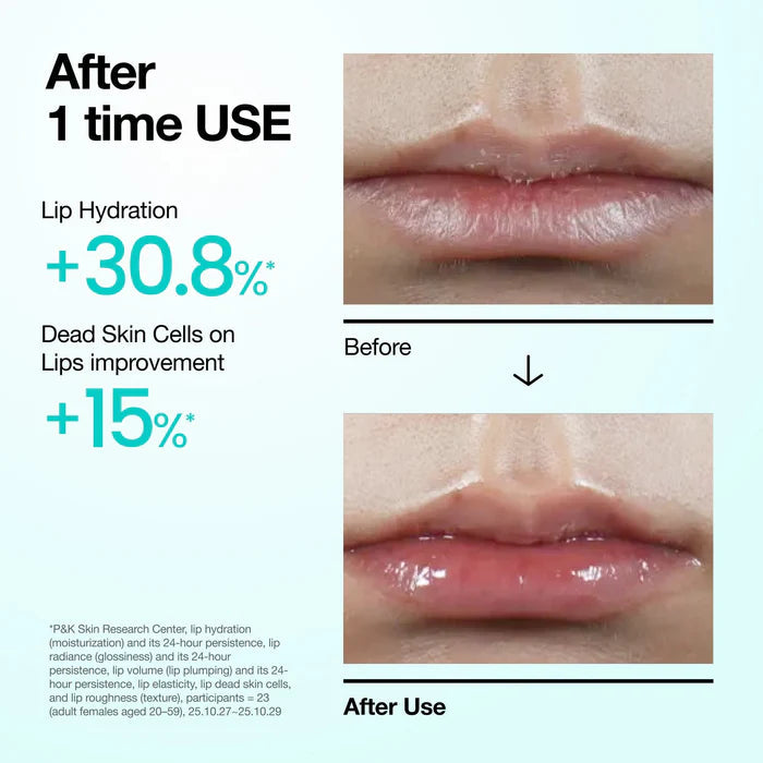 Anua - PDRN Hyaluronic Acid Lip Serum 10ml